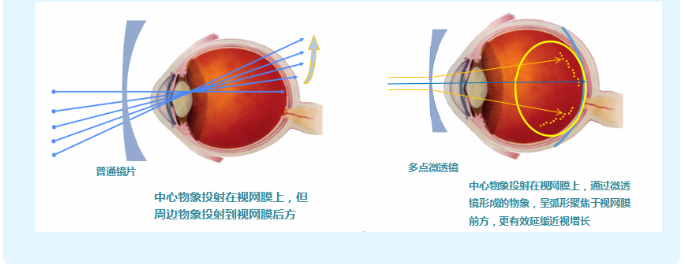 研究11